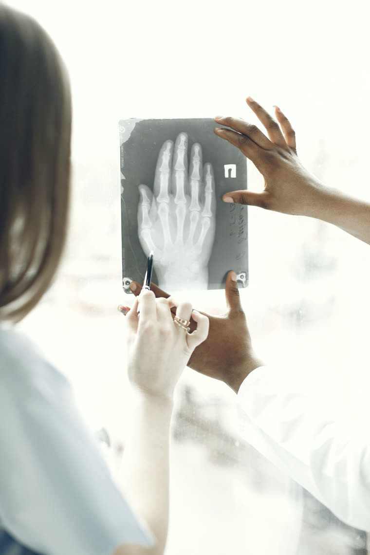 Radiografia di una mano esaminata da due operatori