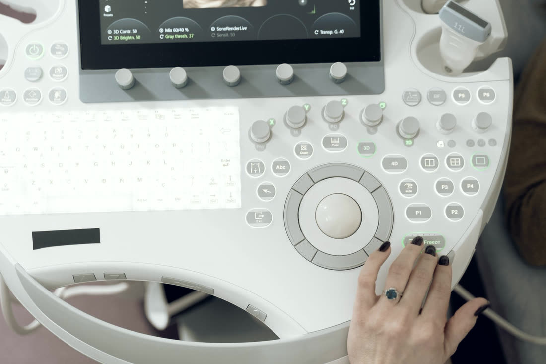 Console di un ecografo con la sonda